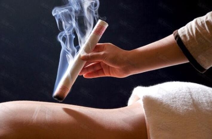 Indirect moxibustion therapy at our Richmond Hill clinic location