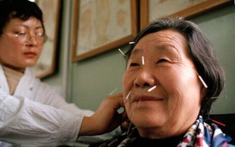 A patient receiving acupuncture treatment